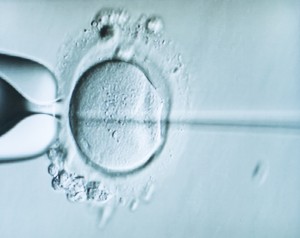Procedimiento de una FIV con Inyección Intracitoplasmática