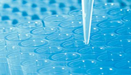Fécondation in vitro