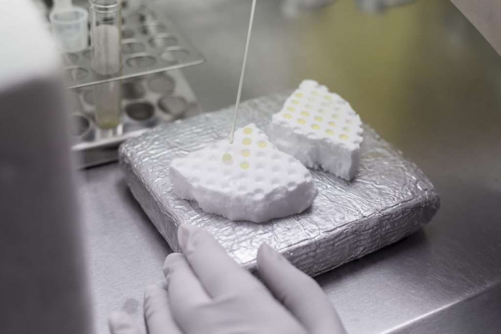 estudio fertilidad en cáncer testicular de IVI y la UJA