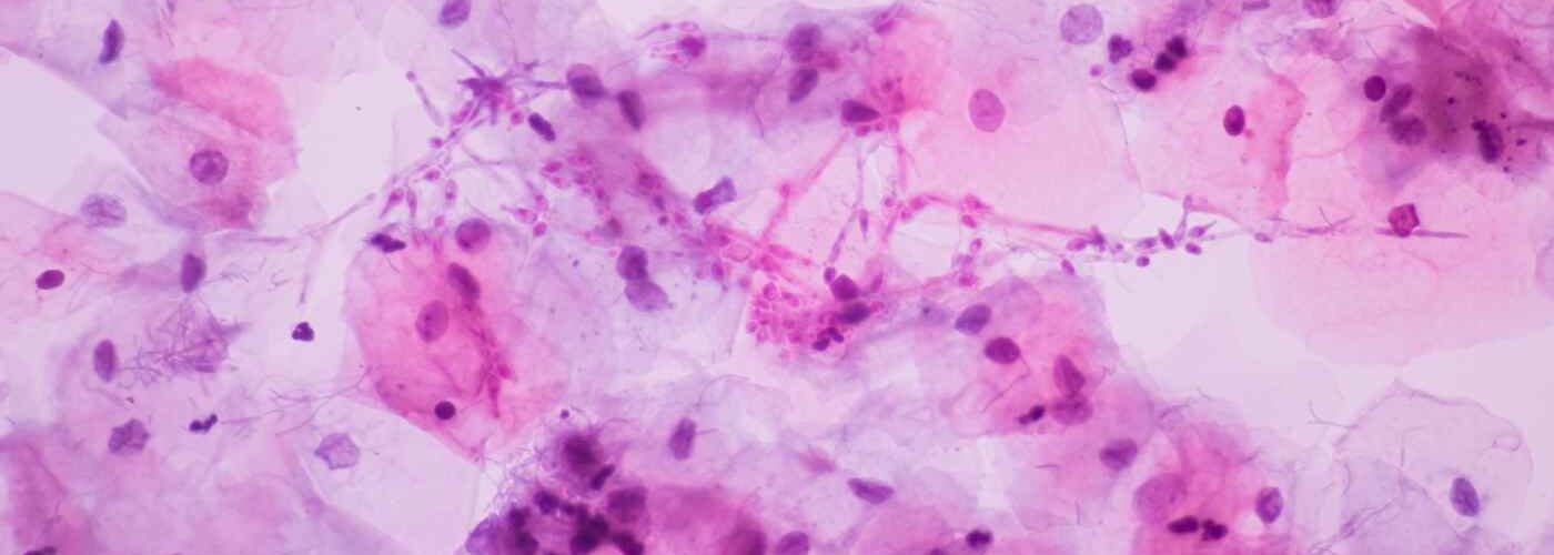 Infecciones del aparato reproductor