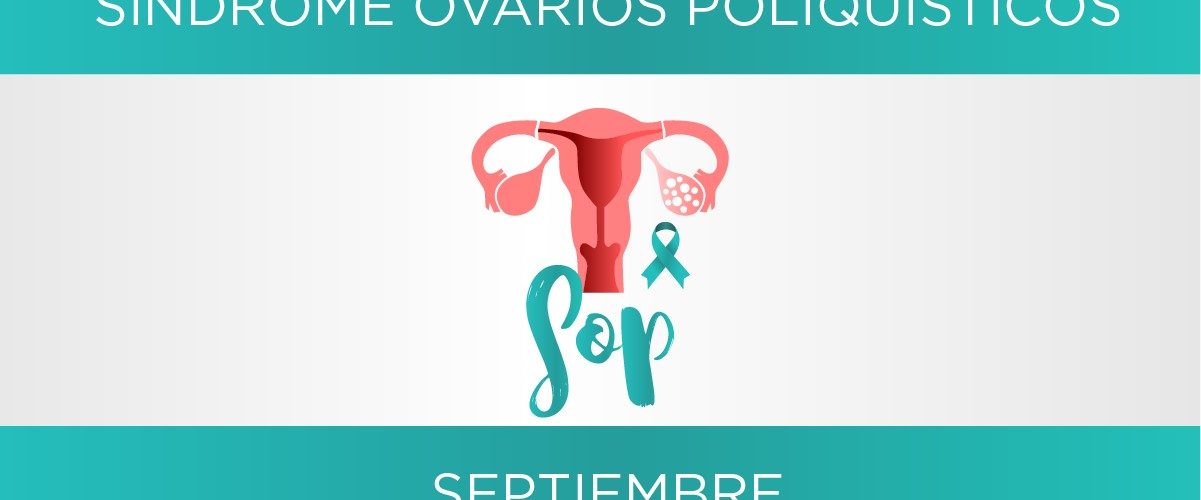 síndrome ovarios poliquísticos