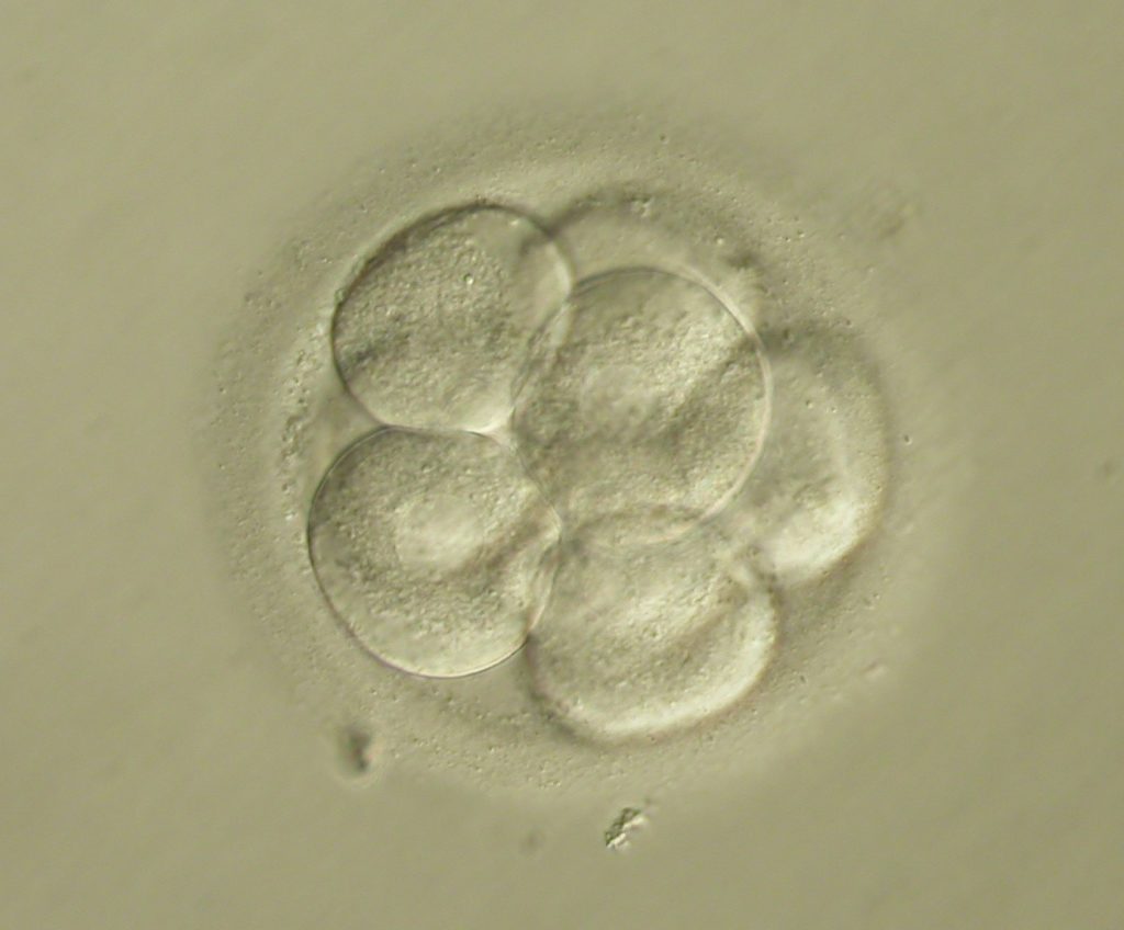 Qué es y en qué consiste una Biopsia Embrionaria