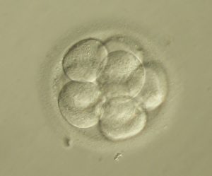 biopsia-embrionaria