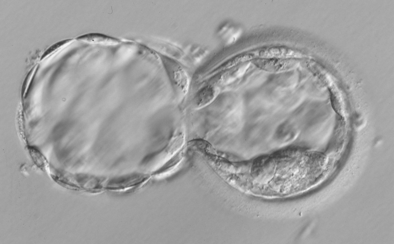 Qué es y en qué consiste una Biopsia Embrionaria
