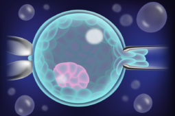 biopsia embrionaria en IVI