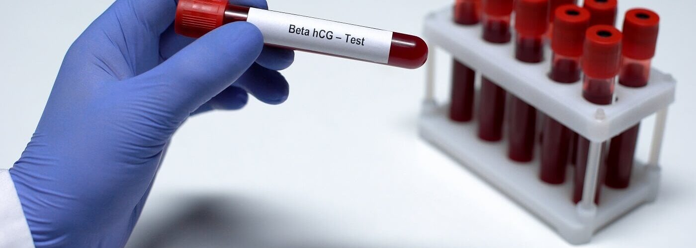 hormona-embarazo-baja-minifiv