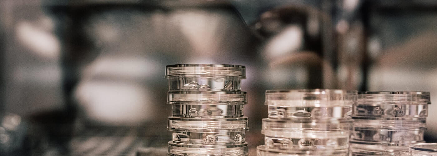 transferencia embrionaria