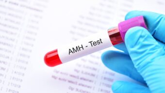 Hormona antimulleriana: valores por edad