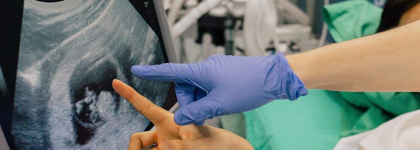 preparar endometrio para transferencia