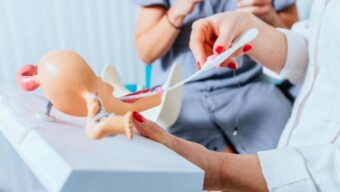 Cuidados después de la inseminación artificial
