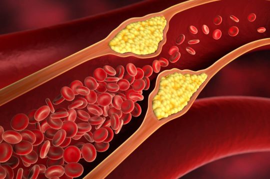 El colesterol alto, enemigo de la fertilidad en hombres y mujeres