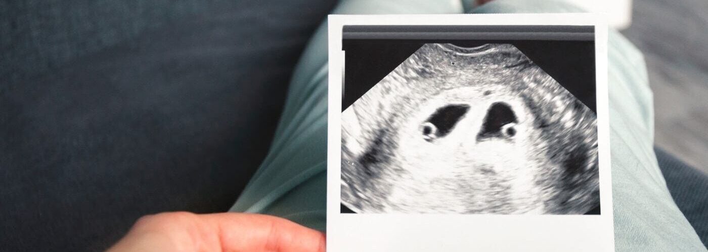 probabilidad de embarazo múltiple con fiv