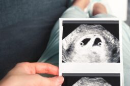 ¿Qué probabilidad de embarazo múltiple hay con FIV?