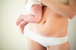 Embarazo tras cesárea: ¿cuánto debo esperar?