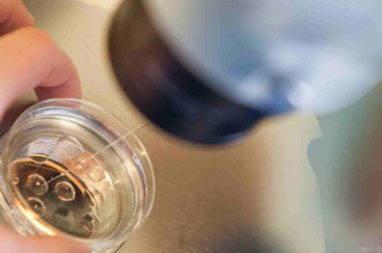 Descubren alteraciones en el endometrio de mujeres con endometriosis que pueden influir en el desarrollo del embarazo