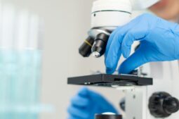 Un análisis de sangre podría ayudar a diagnosticar la adenomiosis de forma no invasiva